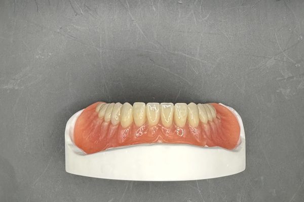 Lower Denture Front view IMG_2792