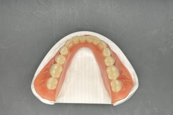 Lower Denture Top View IMG_2791